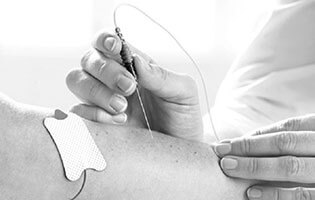 نوار عصب و عضله