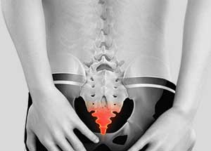 درمان درد دنبالچه