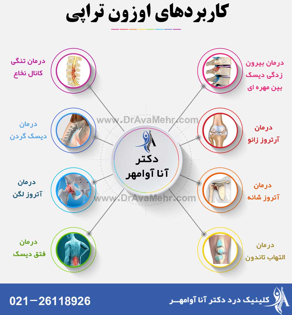 کاربردهای اوزون تراپی