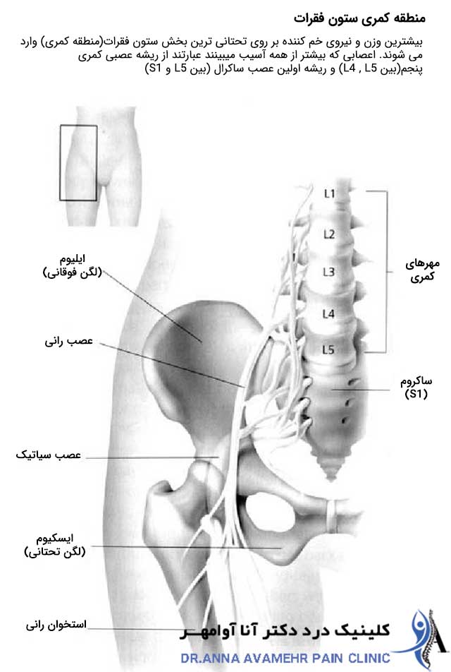 آناتومی ستون فقرات و دیسک های l4 , l5
