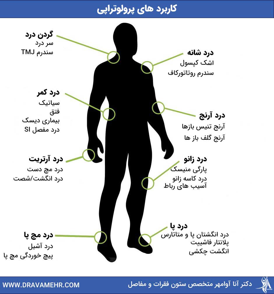 کاربردهای پرولوتراپی