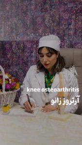 آرتروز زانو