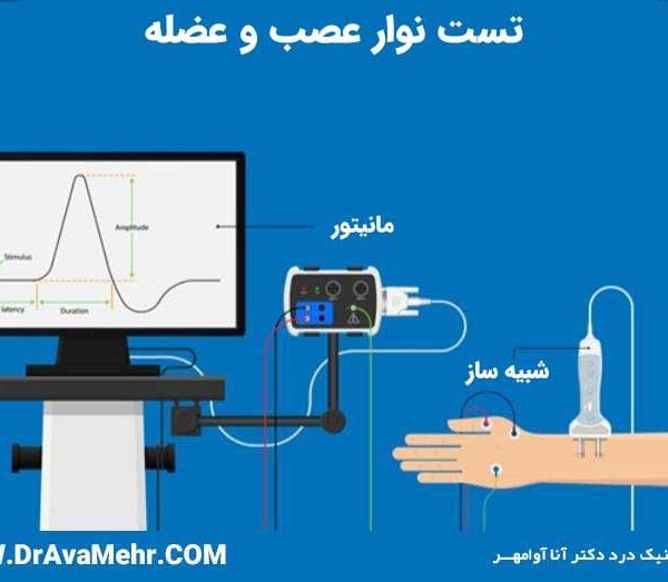 کاربرد تست نوار عصب و عضله
