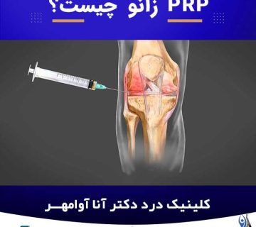 prp زانو چیست