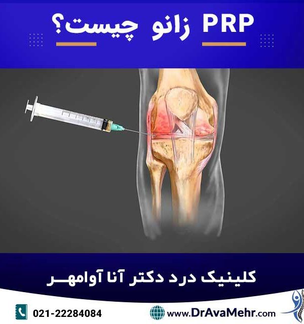 prp زانو چیست