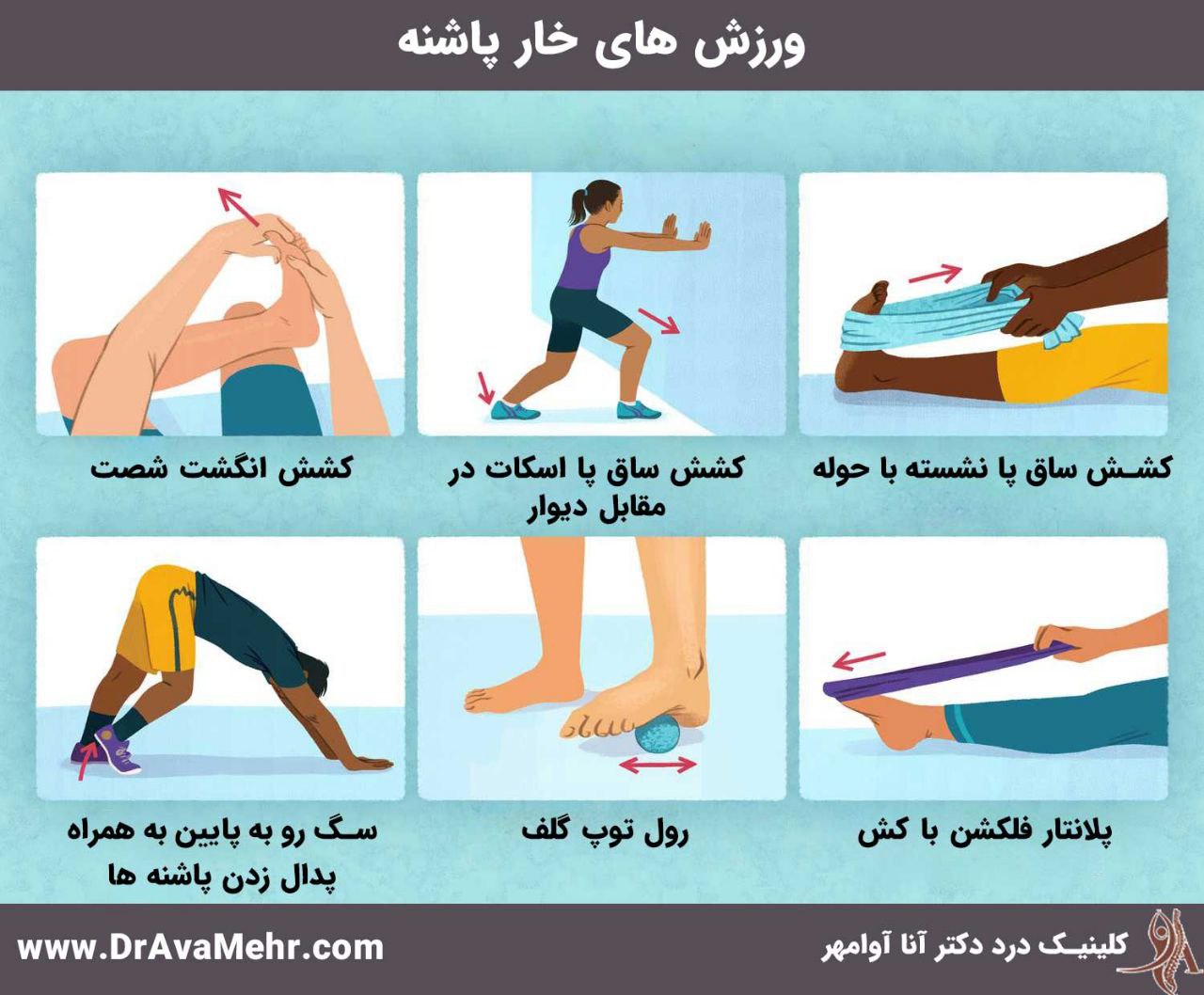 تمرینات ورزشی برای درمان خار پاشنه