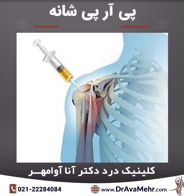 پی آر پی شانه