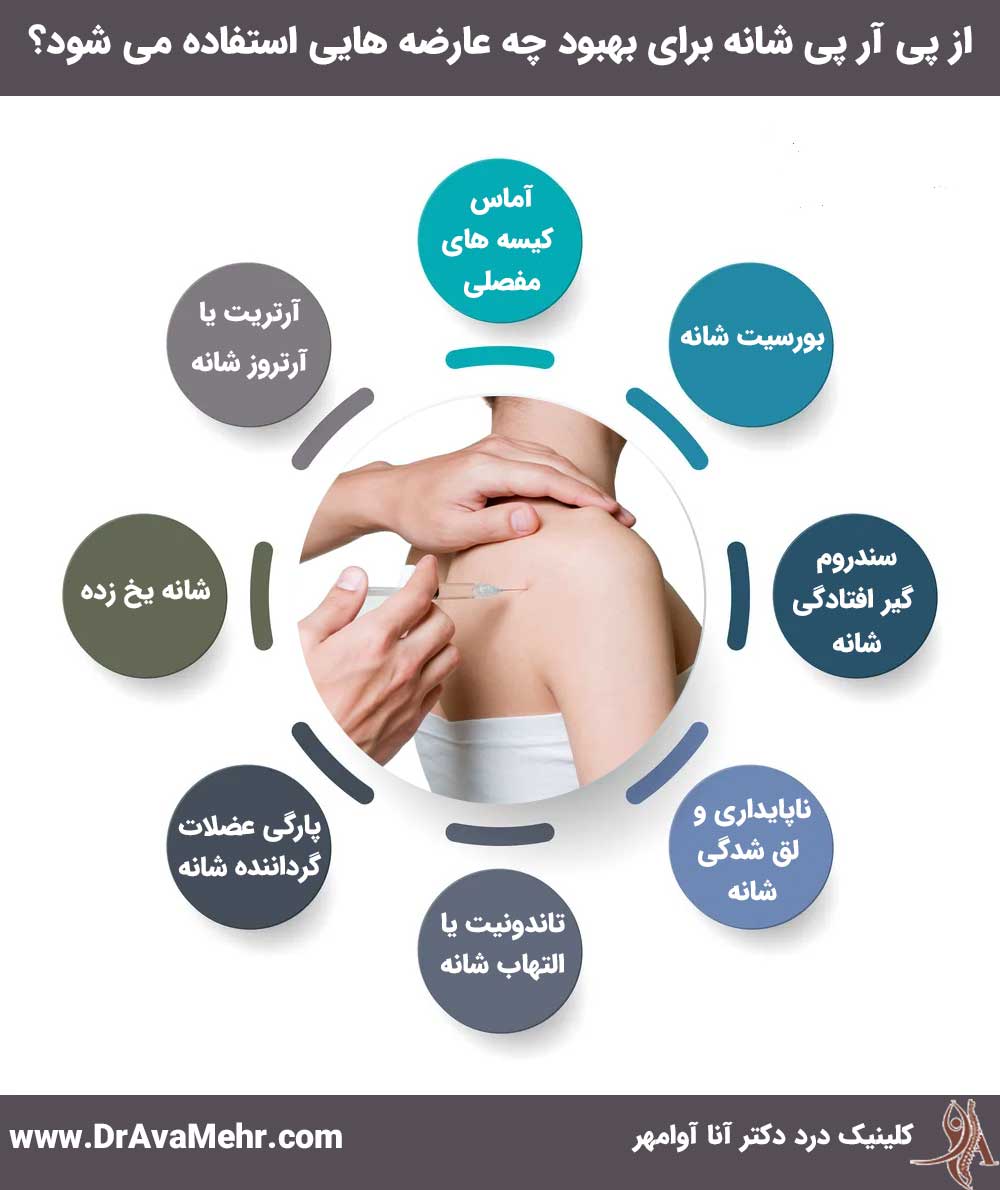 کاربردهای پی آر پی شانه