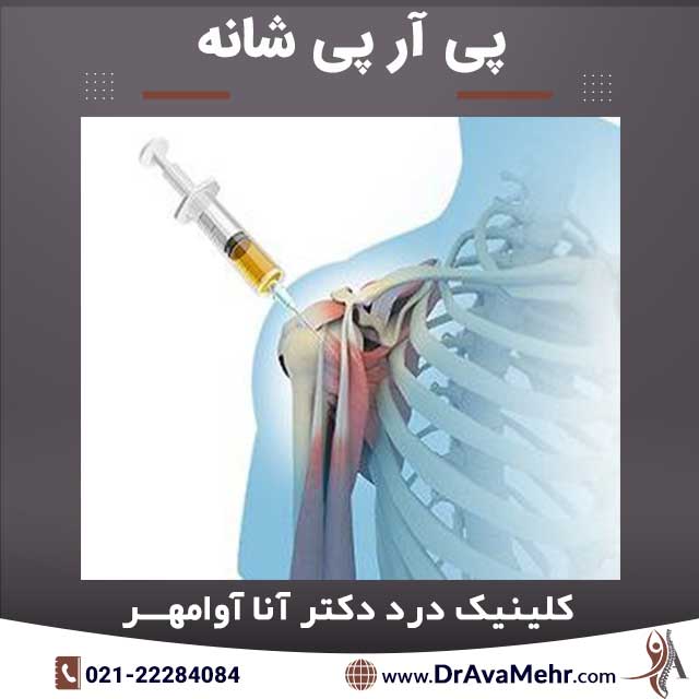 پی آر پی شانه