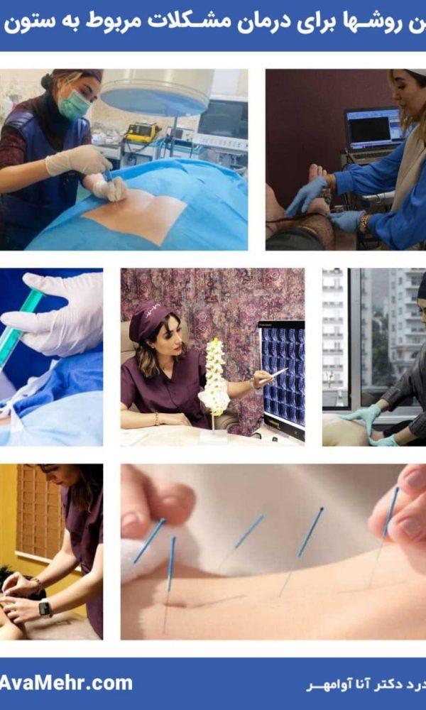 موثرترین روشهای درمان ارائه شده توسط متخصص ستون فقرات