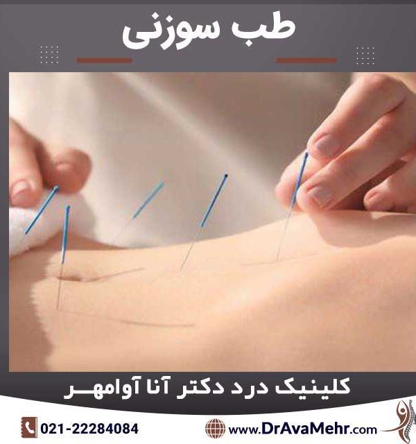 طب سوزنی چیست