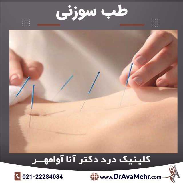 طب سوزنی چیست