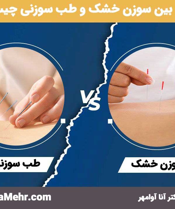 تفاوت بین سوزن خشک و طب سوزنی