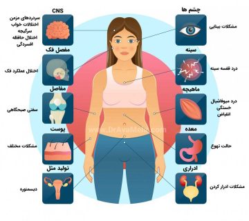 علائم فیبرومیالژیا