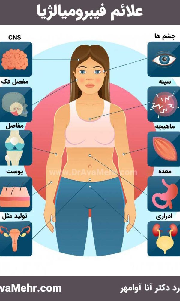 علائم فیبرومیالژیا