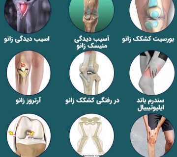 علت زانو رد