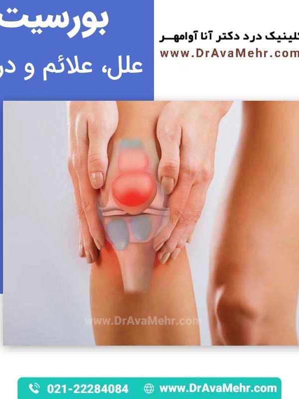 علائم بورسیت