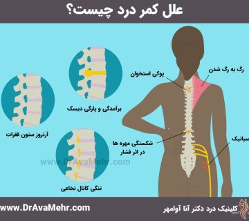 علت کمر درد چیست