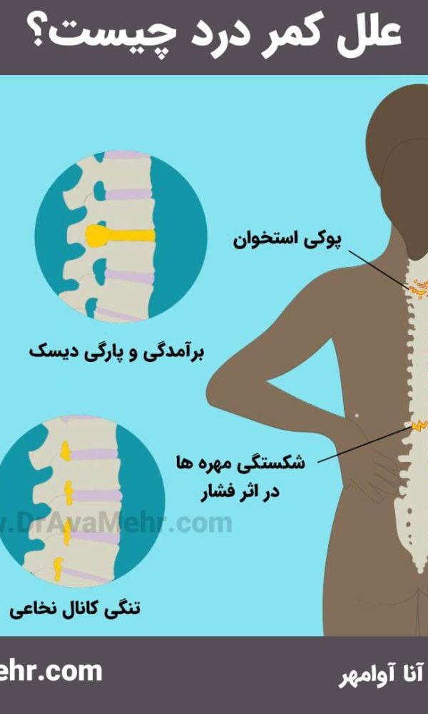 علت کمر درد چیست