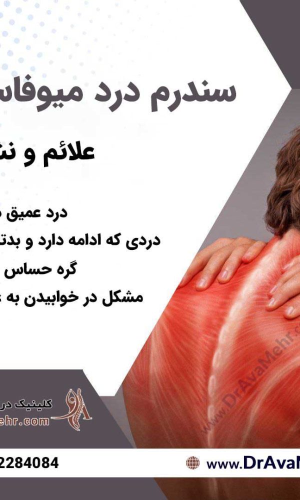 علائم ابتلاء به سندرم درد میوفاسیال